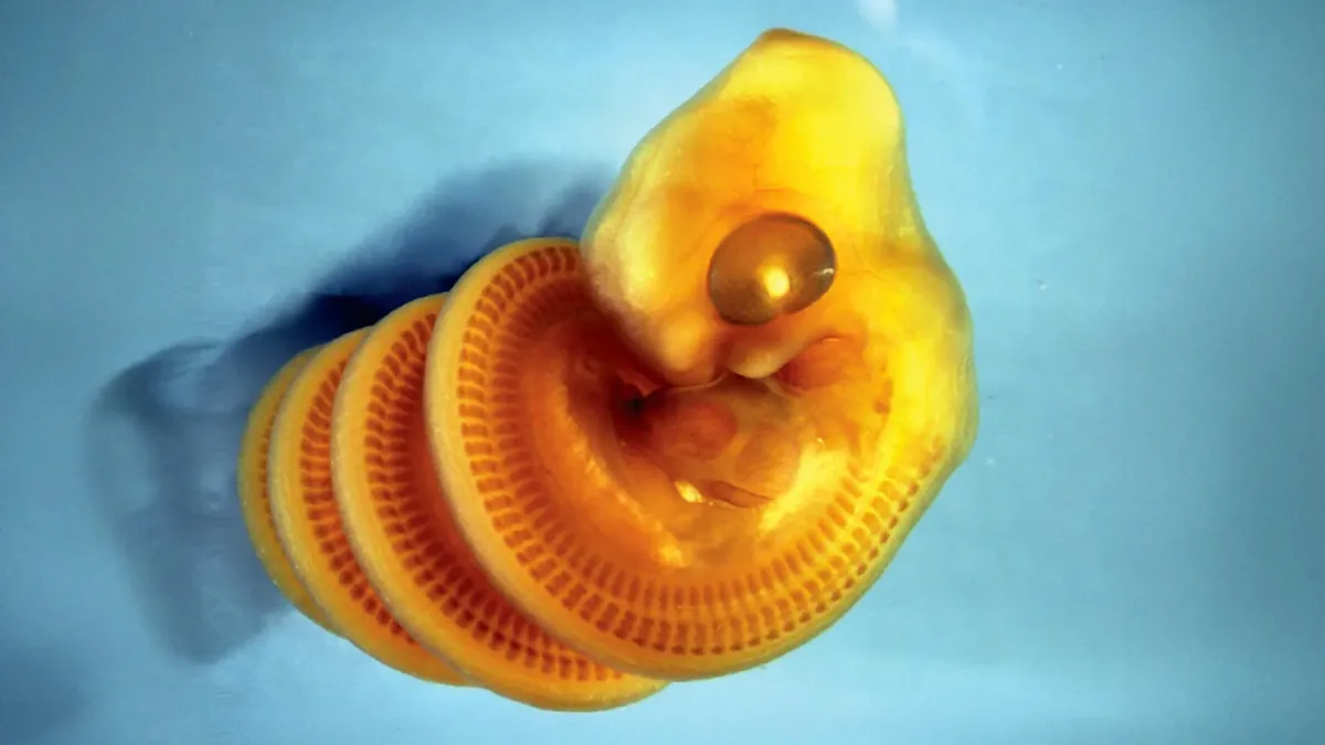 Snake Embryos Twist into Spirals Due to Gut Constraint
